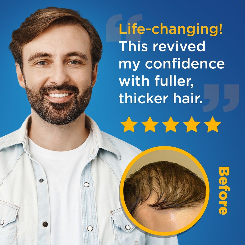 Minoxidil Liquid 5%