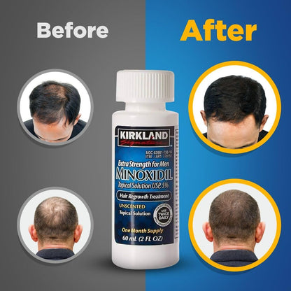 Minoxidil Liquid 5%